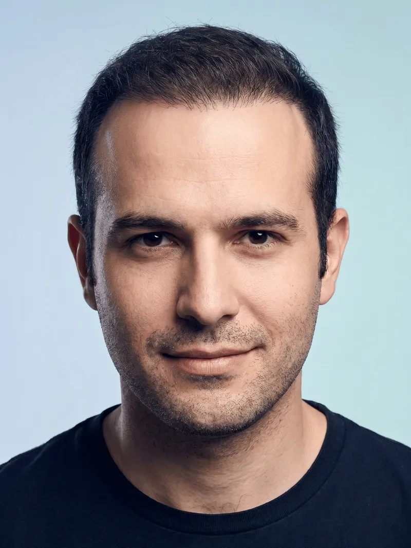 Hair transplant after (AI preview)